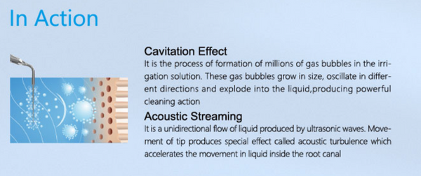 Ultra X™ Cordless Ultrasonic Activator