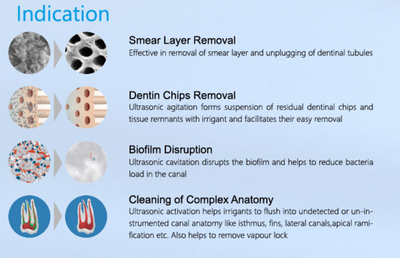 Ultra X™ Cordless Ultrasonic Activator